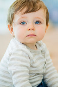 COMMON SIGNS AND SYMPTOMS OF COW MILK ALLERGY